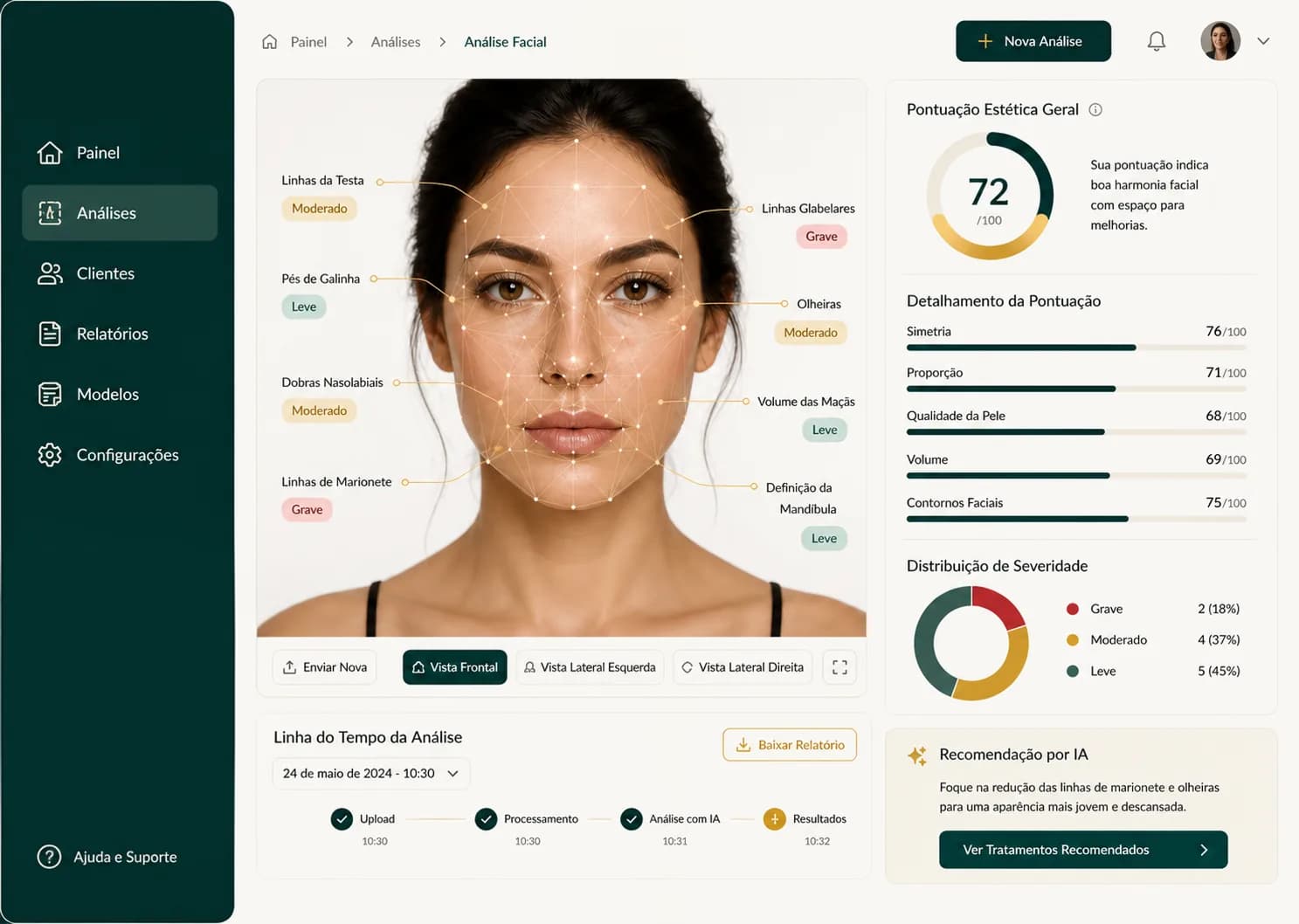 Plataforma Beauty Scan AI com análise Full Face: regiões do rosto marcadas, severidade e pontuação