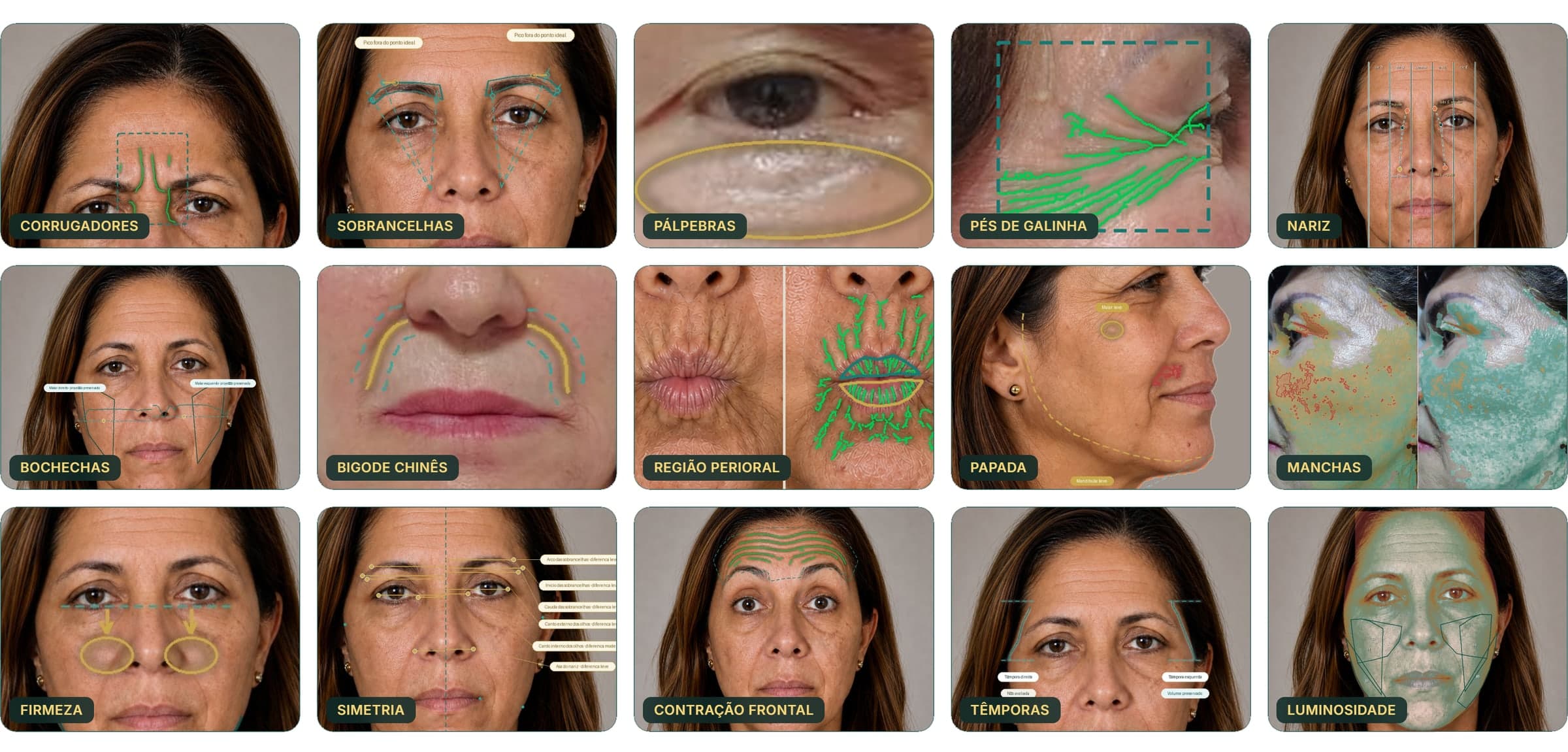 Mosaico de imagens técnicas do Beauty Scan AI, região por região do rosto